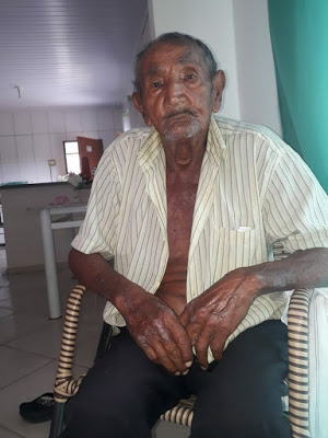 Morre, em Campos Belos (GO), “Seu Arlindo”. Ele não suportou o intenso sofrimento da hemodiálise e desistiu do tratamento